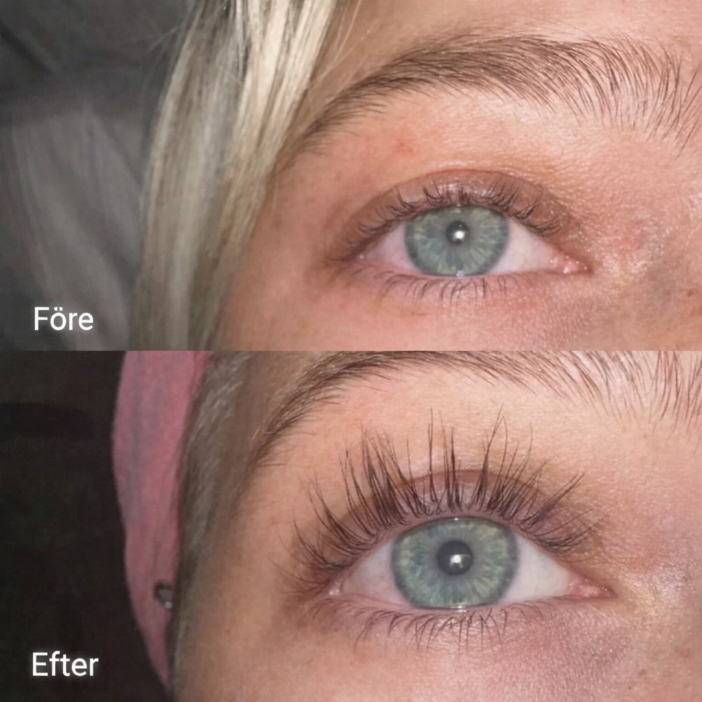 Suero Reconstructor de Pestañas Dobles FORCHICS™: Fuerza, Longitud, Belleza. - Compra 1 y llévate 1 GRATIS