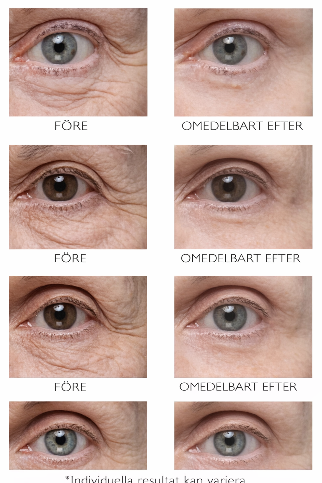 Peter Thomas Roth Instant FIRMx® Eye™: reafirmación instantánea y ojos visiblemente más suaves