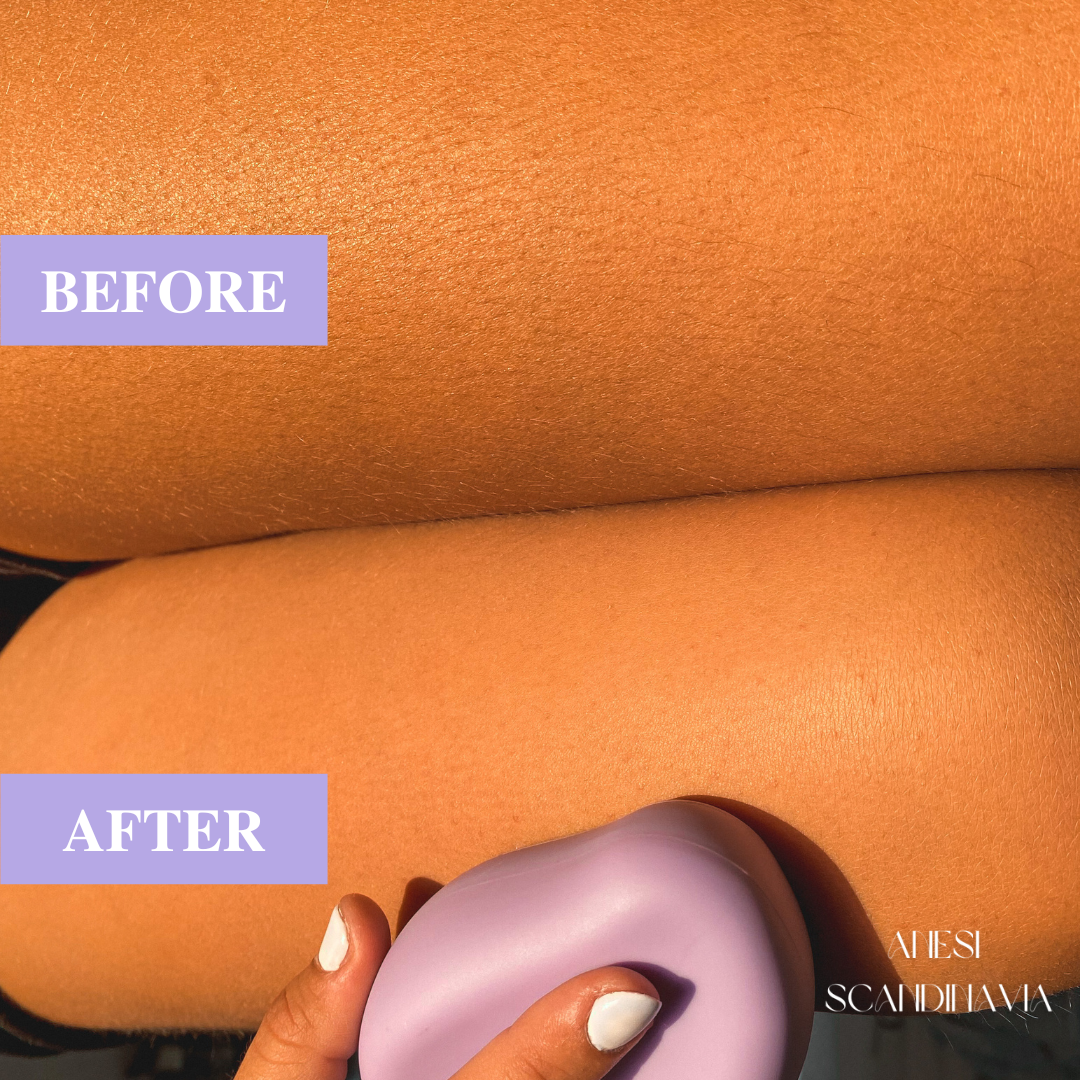 HÈSTIA™ Depiladora Indolora